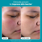 Paula's Choice 2% BHA Liquid Exfoliant 118ml - Salicylic Acid for Blackheads & Pores