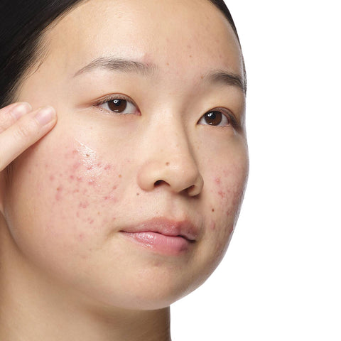 The Ordinary Aloe 2% + NAG 2% Solution (30 ml)