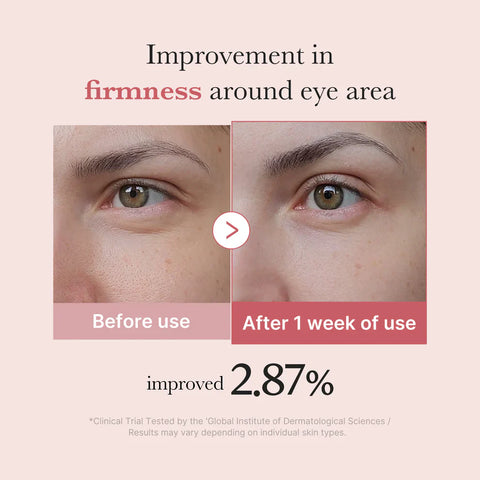 Medicube PDRN Pink Peptide Eye Cream – 30 mL
