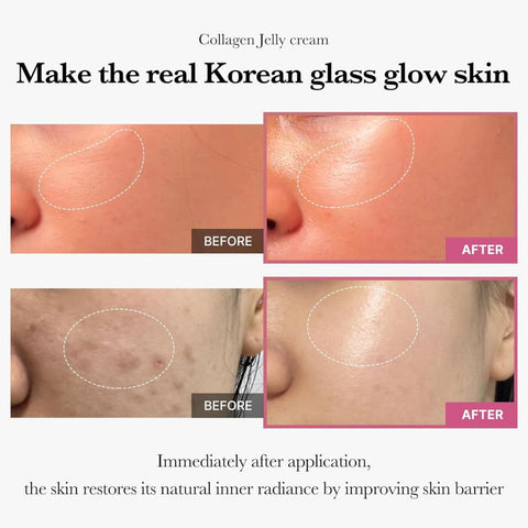 Medicube Collagen Jelly Cream For All Skin Type (110 ml)