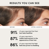 OUAI Scalp Serum for Thicker, Fuller-Looking Hair