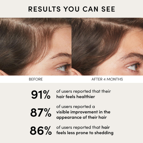 OUAI Scalp Serum for Thicker, Fuller-Looking Hair