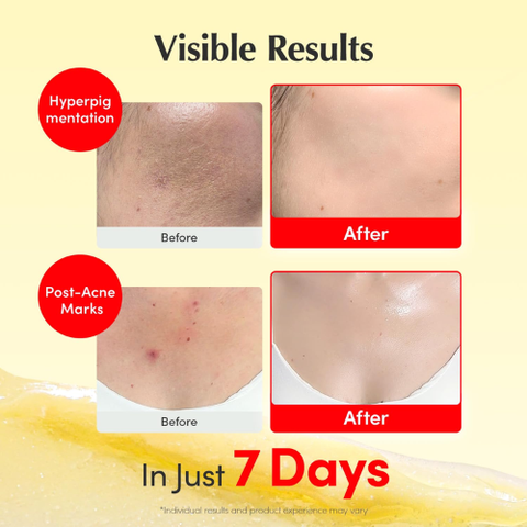 EQQUALBERRY Vitamin C Cream | Brightening & Spot Care